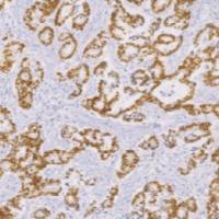 兔抗人CDX2单克隆抗体 TDCCR-0821