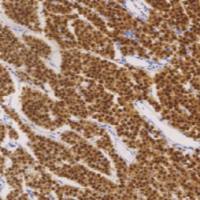 鼠抗人OCT3/4单克隆抗体  TDCOM-0061