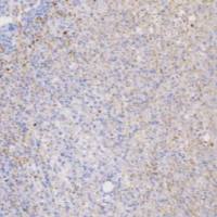 鼠抗人神经丝蛋白抗体单克隆抗体  TDCNM-0041