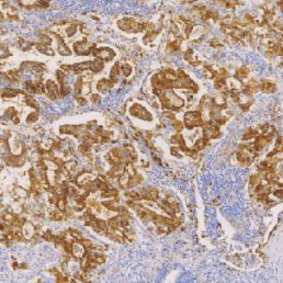 鼠抗人肺表面活性蛋白A单克隆抗体  TDCSM-0200