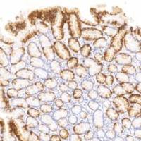 鼠抗人细胞角蛋白20单克隆抗体 TDCCM-1113