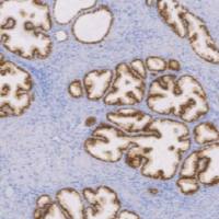 兔抗人NKX3.1单克隆抗体  TDCNR-0060