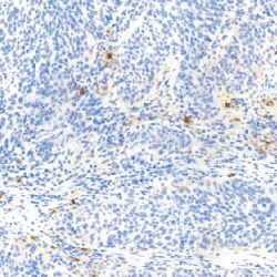 鼠抗人类胰蛋白酶单克隆抗体  TDCTM-0200