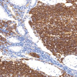鼠抗人巢蛋白单克隆抗体  TDCNM-0030