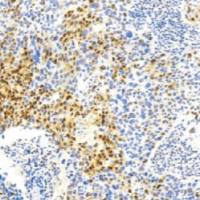 鼠抗人p21(WAF1蛋白)单克隆抗体 TDCPM-0111