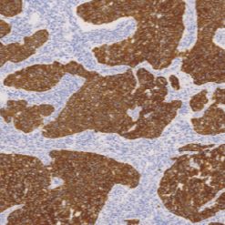 鼠抗人细胞角蛋白7单克隆抗体  TDCCM-0991