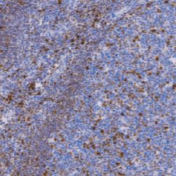 兔抗人多发性骨髓瘤癌基因（MUM-1)单克隆抗体  TDCMR-0301