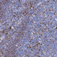 兔抗人多发性骨髓瘤癌基因（MUM-1)单克隆抗体  TDCMR-0301