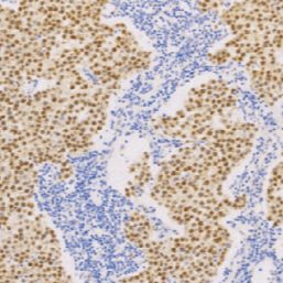 兔抗人八聚体结合转录因子4单克隆抗体 TDCOR-0021