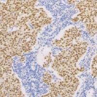 兔抗人八聚体结合转录因子4单克隆抗体  TDCOR-0021