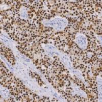 鼠抗人p53蛋白单克隆抗体  TDCPM-0142