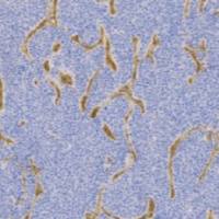 鼠抗人 IV 型胶原单克隆抗体 TDCCM-1131