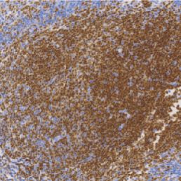 鼠抗人Pax-5单克隆抗体  TDCPM-0244