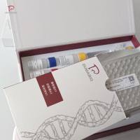 人可溶性白细胞分化抗原28(sCD28)ELISA试剂盒