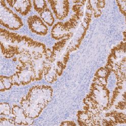 兔抗人SATB2单克隆抗体  TDCSR-0140