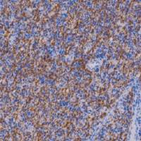 鼠抗人髓鞘碱性蛋白单克隆抗体 TDCMM-0320