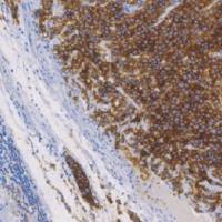 鼠抗人D2-40 单克隆抗体 TDCDM-0010