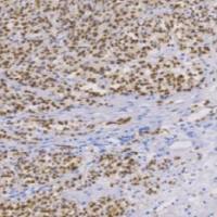 鼠抗人MiTF单克隆抗体  TDCMM-0170