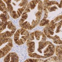 兔抗人E-钙粘附蛋白单克隆抗体 TDCER-0022