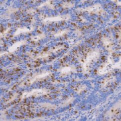 兔抗人存活素单克隆抗体  TDCSR-0290