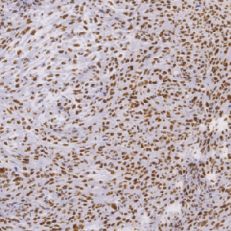 鼠抗人FLI-1单克隆抗体  TDCFM-0040