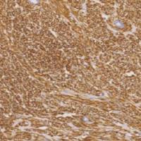 鼠抗人DOG-1单克隆抗体 TDCDM-0033