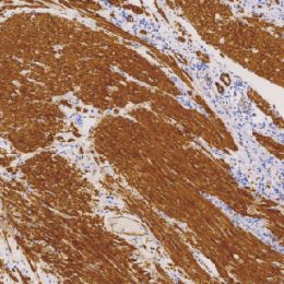 鼠抗人肌球蛋白重链（平滑肌）单克隆抗体  TDCMM-0360