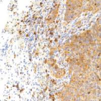 兔抗人生长激素抑制素单克隆抗体 TDCSR-0160