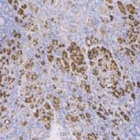 鼠抗人粘液素糖蛋白6 单克隆抗体 TDCMM-0290