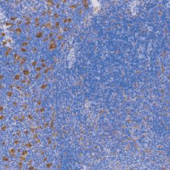 鼠抗人CD68（巨噬细胞）单克隆抗体  TDCCM-0704