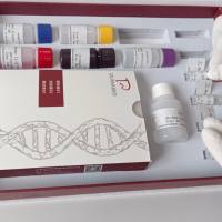 人可溶性凋亡相关因子(sFAS/Apo-1)ELISA试剂盒价格