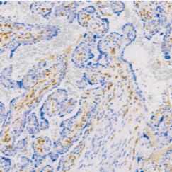 兔抗人凝血因子XIIIa单克隆抗体  TDCFR-0010