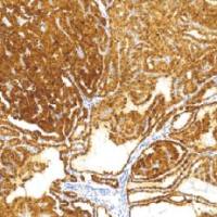 兔抗人半乳凝集素-3单克隆抗体 TDCGR-0101