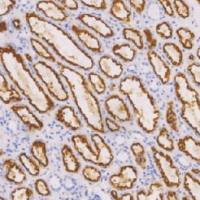 鼠抗人肾细胞癌标记物单克隆抗体  TDCRM-0021