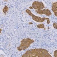 兔抗人Desmoglein-3单克隆抗体 TDCDR-0040