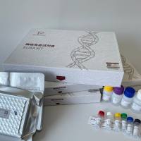 人白细胞分化抗原4(CD4)ELISA试剂盒原理