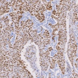 兔抗人神经(管)嵴转录因子2单克隆抗体 TDCSR-0171