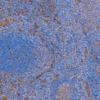 鼠抗人成束蛋白单克隆抗体 TDCFM-0031