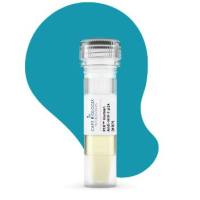 PtX™ Human Anti-HIV-1 p24 (HRP)