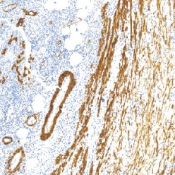 鼠抗人平滑肌肌动蛋白单克隆抗体   TDCAM-0191