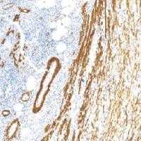 鼠抗人平滑肌肌动蛋白单克隆抗体 TDCAM-0191