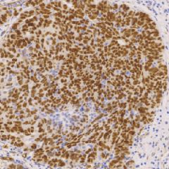 鼠抗人肾母细胞瘤单克隆抗体  TDCWM-0011
