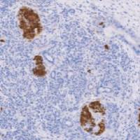 鼠抗人胰岛素单克隆抗体  TDCIM-0170