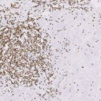 兔抗人ERCC1单克隆抗体 TDCER-0060