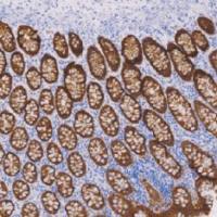 鼠抗人上皮特异性抗原单克隆抗体 TDCEM-0051