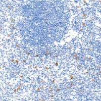 鼠抗人朗格素单克隆抗体  TDCLM-0030