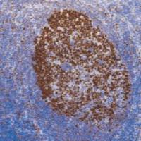 兔抗人MCM2单克隆抗体 TDCMR-0400