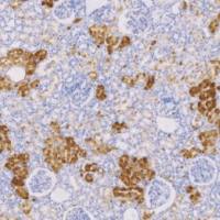 兔抗人S100A1单克隆抗体  TDCSR-0110