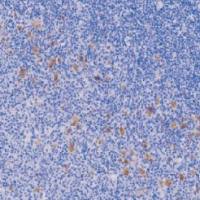 鼠抗人EB病毒单克隆抗体  TDCEM-0010