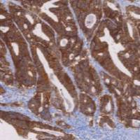 鼠抗人上皮特异性抗原单克隆抗体 TDCEM-0050